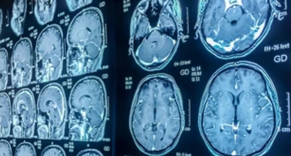 MRI Brain Scan Series DICOM