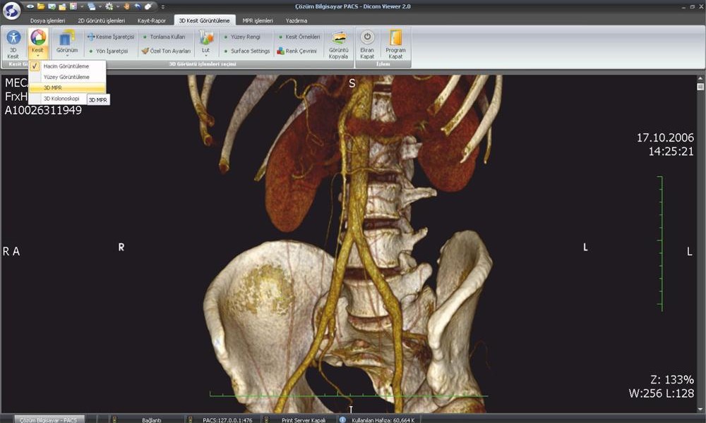 PACS DICOM Viewer Interface